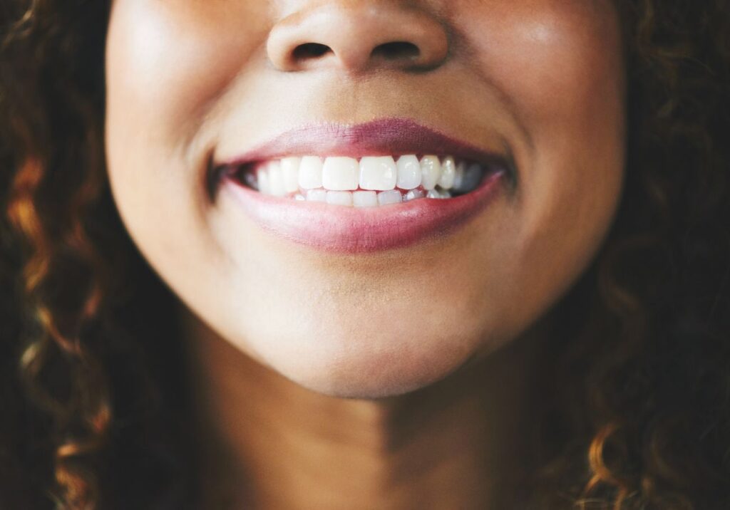 How to Maximize Teeth-Whitening Effects