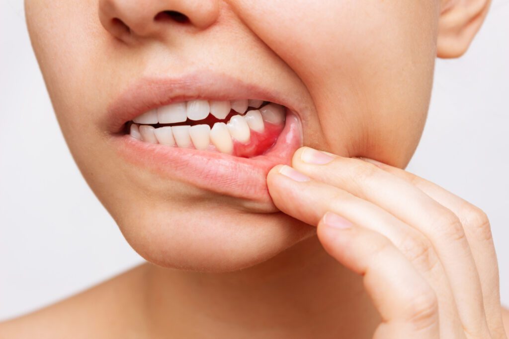Periodontal Disease Treatment in Greenville TX